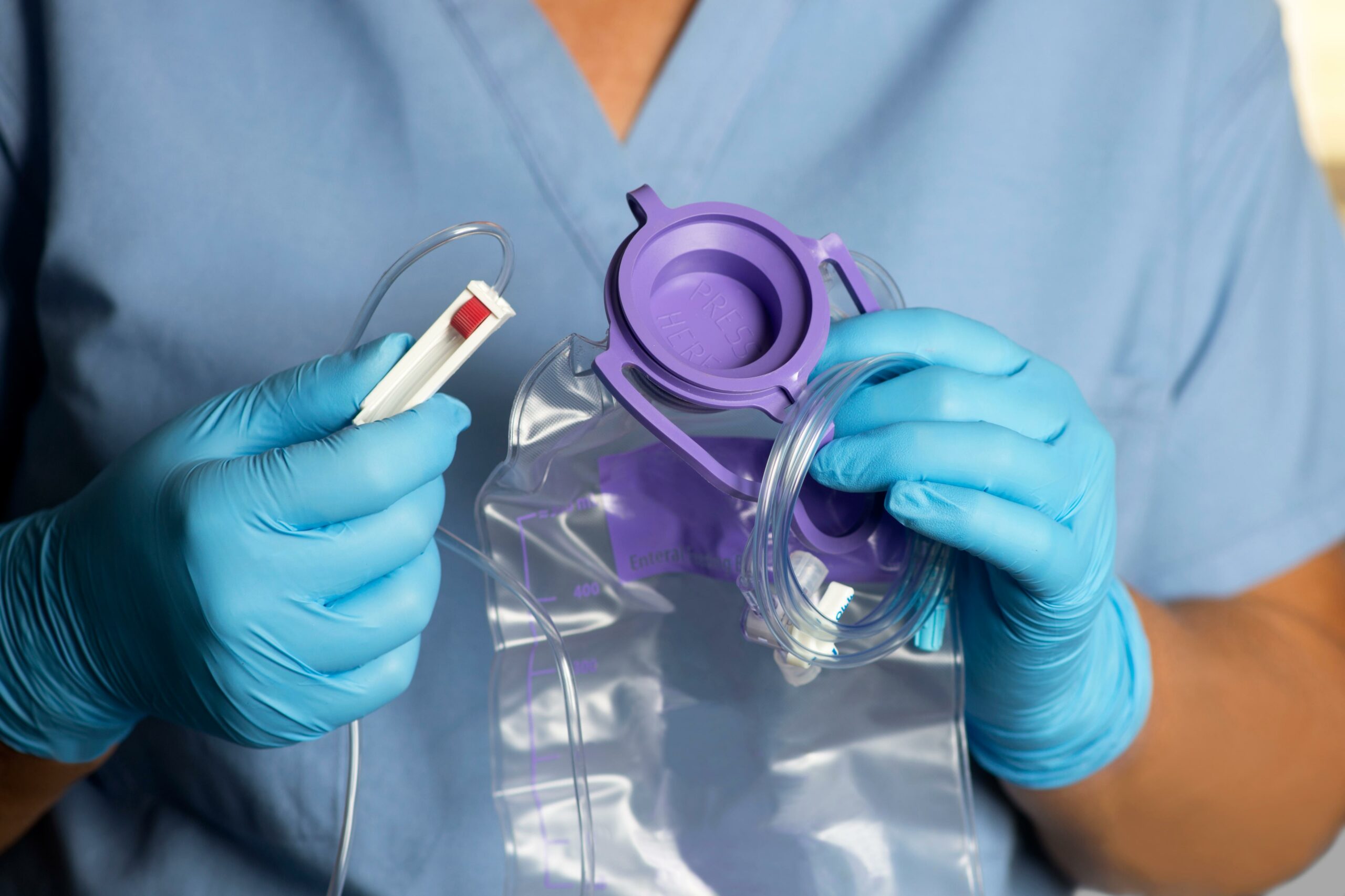 PEG Tube Feeding Equipment